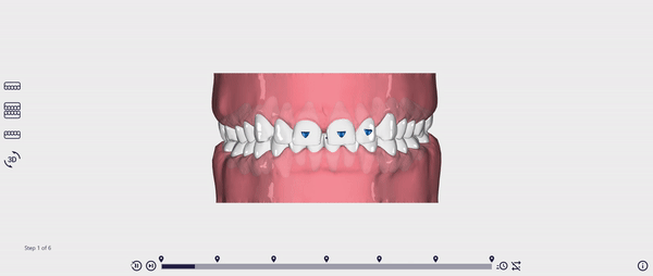 Modern Clear Case Example 3